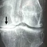 Foto de Dr. Emilio González Rosas, Ortopedia y Traumatología en Mexicali