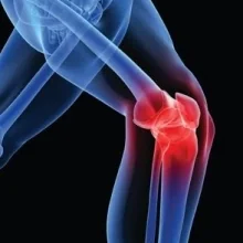 Foto de Dr. Randall Robles Machain, Ortopedia y Traumatología en Tijuana