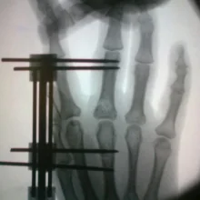 Foto de Dr. Jaime Dante Hernandez Mendoza, Ortopedia y Traumatología en Saltillo