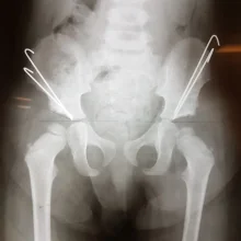 Foto de Dr. Heber Avitia Salazar, Ortopedia y Traumatología en Durango