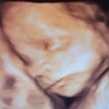 Foto de Dr. Raúl Leos Mata, Ginecología y Obstetricia en Durango