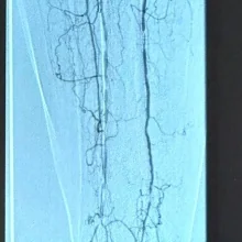 Foto de Dr. Erik Bravo Arriola, Cirugía General en Celaya