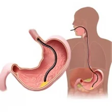 Foto de Dr. Antonio Zamorano Cruz, Cirugía General en Pachuca