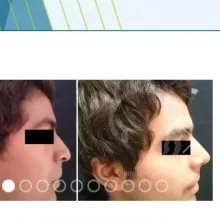 Foto de Dr. Lizbeth Espinoza, Otorrinolaringología en Guadalajara