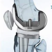 Foto de Dr. Mónica Martínez Sánchez, Ortopedia y Traumatología en Guadalajara