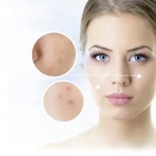 Foto de Dr. Patricia Judith Méndez Cotero, Dermatología en San Luis Potosí