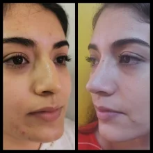 Foto de Dr. Álvaro Sandoval Argüelles, Otorrinolaringología en Los Mochis