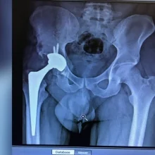 Foto de Dr. Sergio Vazquez Soto, Ortopedia y Traumatología en Villahermosa