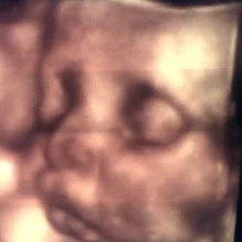 Foto de Dr. María Elena Herrera Delgadillo, Ginecología y Obstetricia en Matamoros