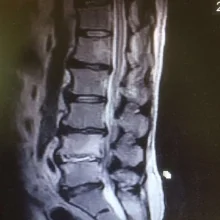 Foto de Dr. Ramiro Zenon Gonzalez Garcia, Neurocirugía en Reynosa